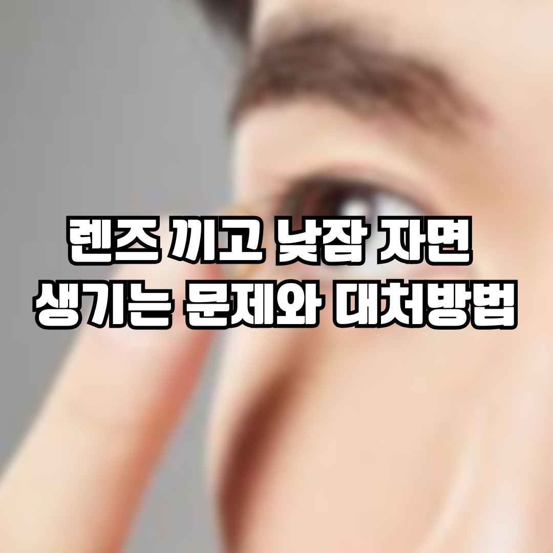 렌즈 끼고 낮잠 대처방법