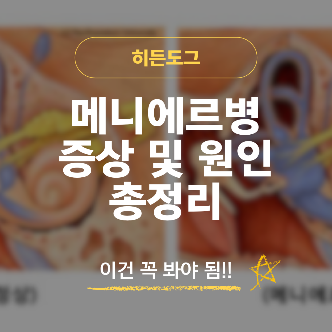 메니에르병 증상 및 원인 총정리